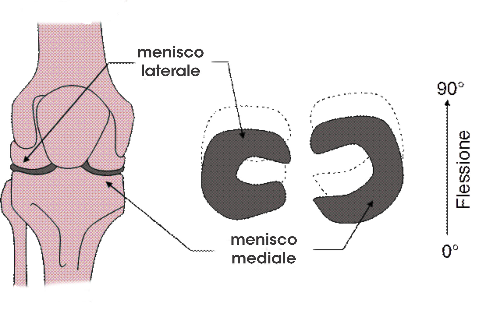 menisco-ginocchio